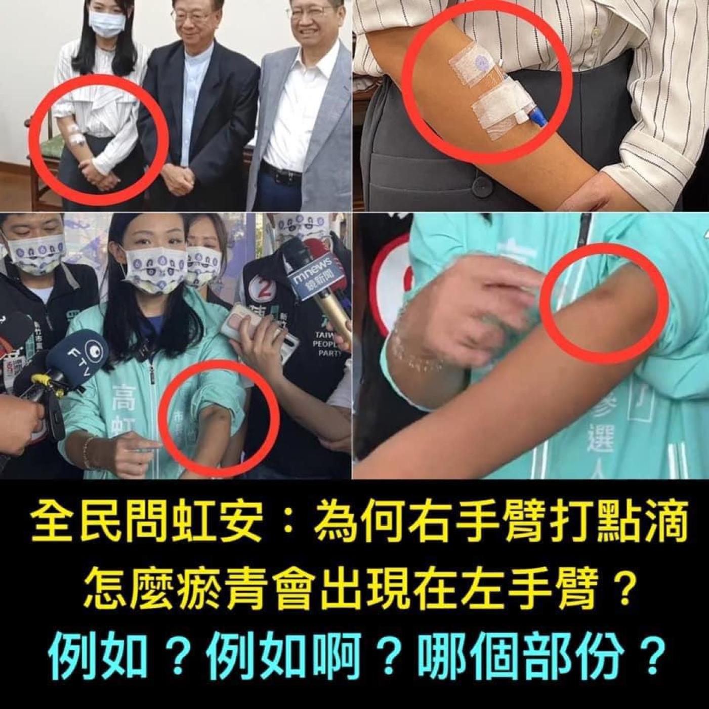 網友質疑高虹安打點滴右手變左手。翻攝周玉蔻臉書